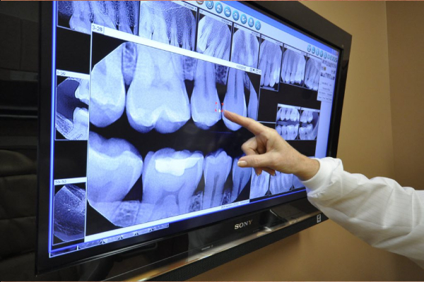 Digital Dental X-Ray